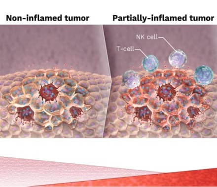 A 3-panel Mechanism Of Action 3D Illustration that shows how pelareorep, a novel anti-cancer therapy from Oncolytics Biotech affects non-inflamed, partially inflamed, and fully inflamed tumors.