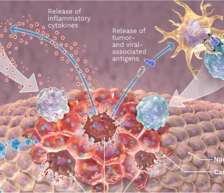 A Mechanism Of Action 3D Illustration that showcases how pelareorep, a novel anti-cancer therapy from Oncolytics Biotech works to treat a variety of cancers